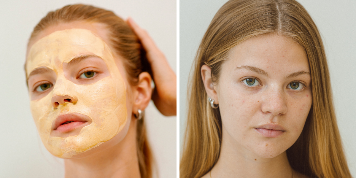 These Turmeric Products Won’t Stain Your Skin